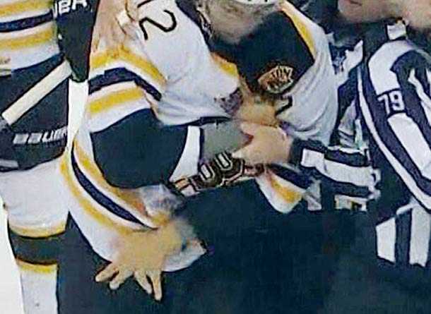 Jarome Iginla suffered a gruesomely wrenched finger in a fight with Ryan Kesler of the Vancouver Canucks